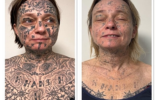 Απίστευτη βαρβαρότητα: Έκανε 250 τατουάζ με το όνομά του στο κορμί της συντρόφου του