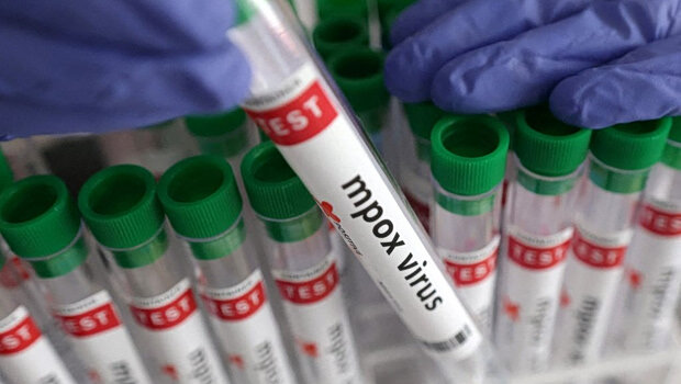 Πρώτο κρούσμα ευλογιάς των πιθήκων (mpox) στην ήπειρο - άνδρας 45 ετών